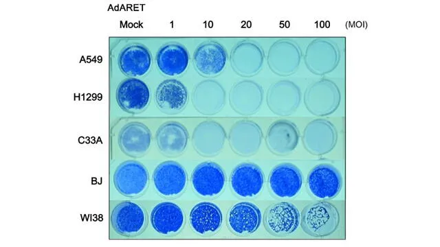 El AdARET eliminó las células cancerosas (A549, H1299 y C33A) de una manera dependiente de la dosis, mientras que las células normales (BJ y WI38) no se vieron afectadas. Foto: Cánceres