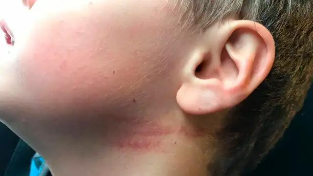 Facebook: Así se enteró que su hijo de 4 años era brutalmente golpeado por su maestra Facebook: Así se enteró que su hijo de 4 años era brutalmente golpeado por su maestra