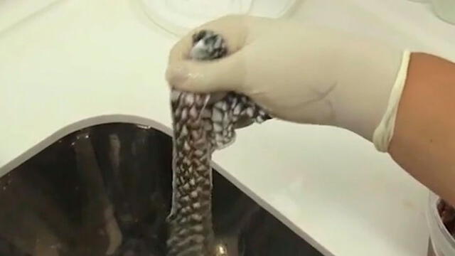 Piel del pez tilapia. Se utiliza para la reconstrucción del aparato reproductor. Foto: captura de video.