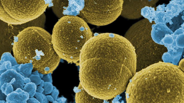 Imagen del estafilococo dorado bajo microscopio electrónico. Fuente: NIAID.