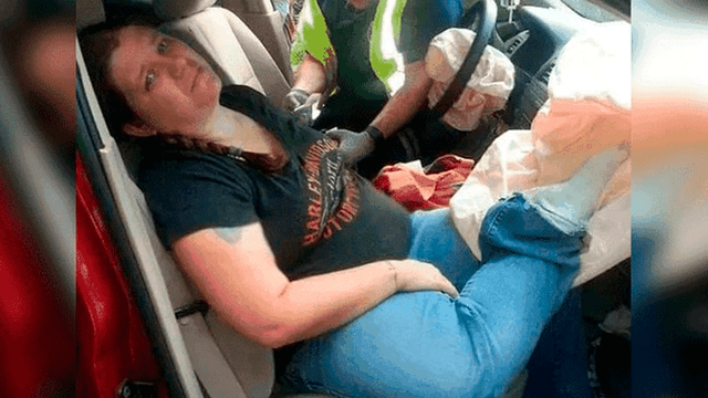 Mujer sufre terrible fractura en accidente por poner sus pies sobre el tablero de auto [FOTOS]