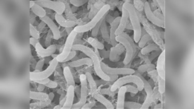 Pelagibacter, o SAR11, es una bacteria unicelular que sobrevive del carbono disuelto en todos los océanos. Crédito: NOAA.