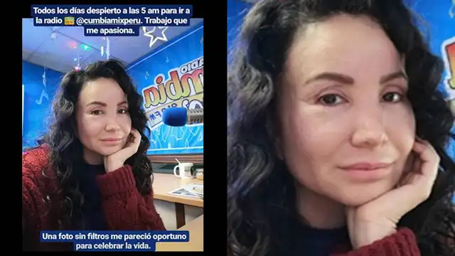 Janet Barboza muestra su belleza natural para demostrar que no usa botox