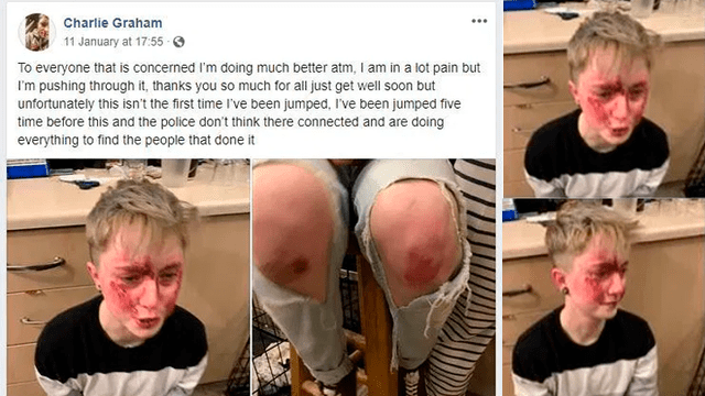 Lesbiana queda con el rostro desfigurado tras ser golpeada por dos hombres en brutal ataque homofóbico [FOTOS]