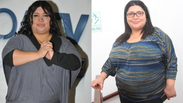 Lucy Cabrera, su antes y después al bajar de peso con banda gástrica
