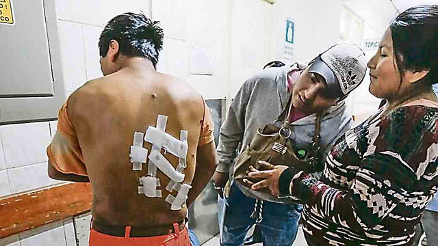 Un gerente fuera y 24 obreros heridos por protesta de construcción civil en Gobierno Regional de Arequipa [VIDEO]