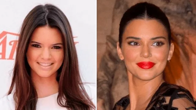 Kendall Jenner, antes y después
