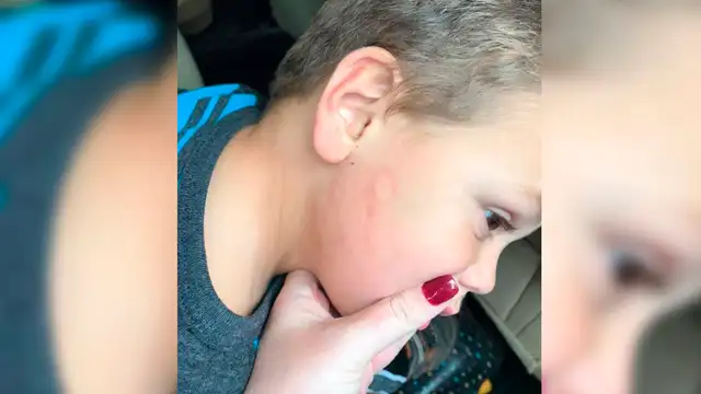 Facebook: Así se enteró que su hijo de 4 años era brutalmente golpeado por su maestra Facebook: Así se enteró que su hijo de 4 años era brutalmente golpeado por su maestra