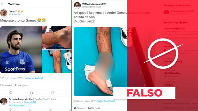 Fotos mostraban graves lesiones en el pie.