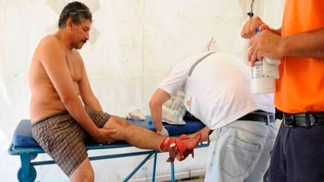 La palometa provoca heridas en la manos y pies. La palometa provoca heridas en la manos y pies.