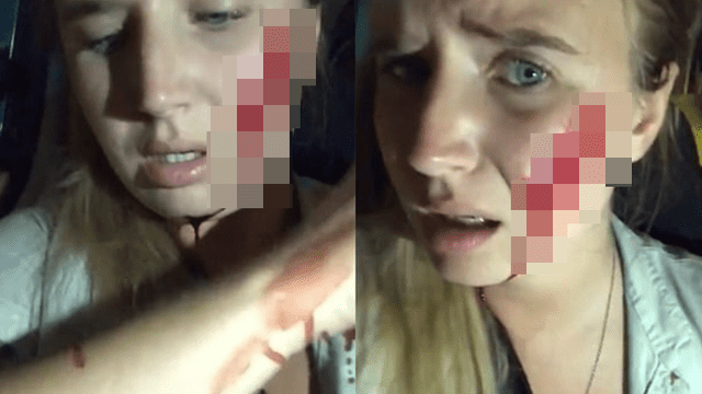 La activista sufrió cortes en el rostro debido al ataque. Foto: Instagram.