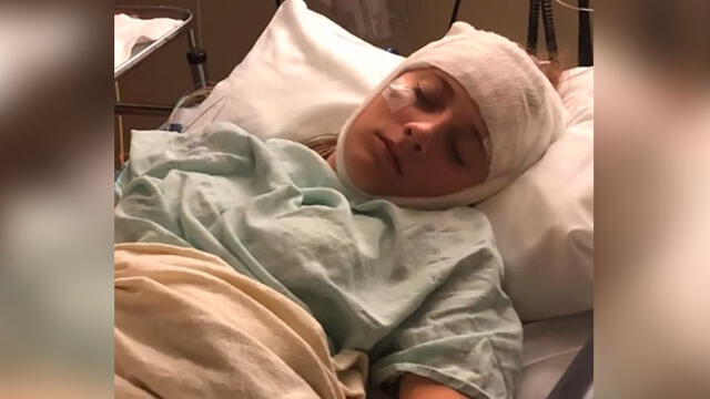 El cerebro de una joven en Estados Unidos se reinicia cada dos horas tras recibir un golpe en la cabeza. Foto: Captura Video.