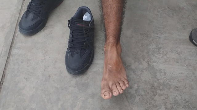 Fiscalizador tiene dificultad para caminar, luego de ser atropellado por mototaxista informal. (Foto: Captura de video / Municipalidad de Surco)