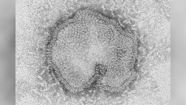 Cepa de la influenza A H7N9. Crédito: CDC.