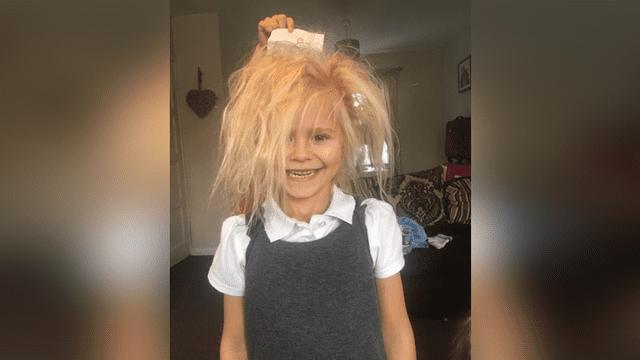 Facebook viral: la llaman "Chucky" por extraña enfermedad que convirtió su cabello negro a rubio lleno de frizz [FOTOS] 