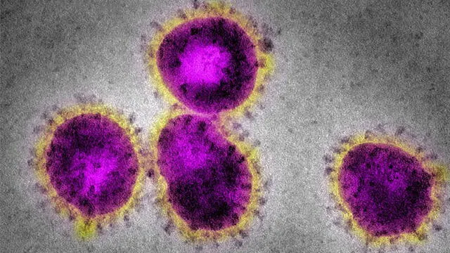 Partículas de SARS-CoV bajo microscopio electrónico. Crédito: CDC.