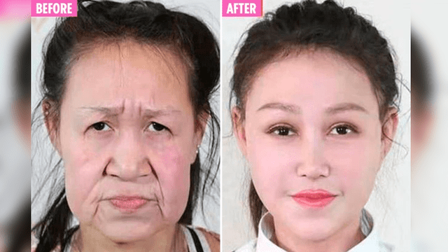 La niña de 15 años que lucía como 60 debido a una rara enfermedad tiene ‘nueva cara’ [VIDEO]