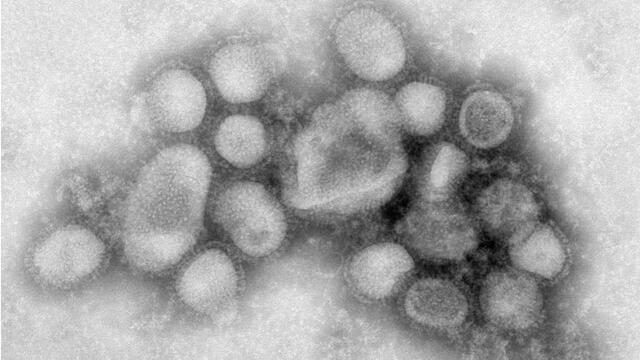 Imagen microscópica de las partículas de virus H1N1 del 2009. Fuente: CDC.