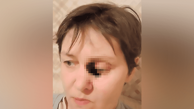 Mujer con el rostro carcomido debido a extraña enfermedad ruega por un diagnóstico [FOTOS]