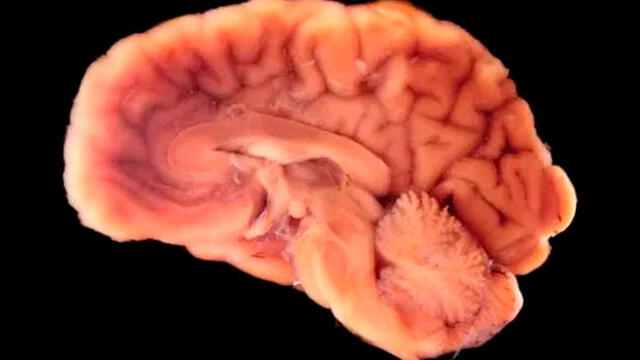 Los cerebros se desarrollaron en un período de aproximadamente nueve meses. Foto: Difusión.