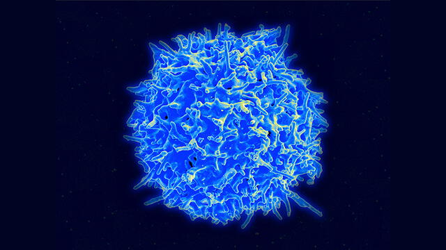 Las células T eliminan otras células que guardan restos del coronavirus en su superficie y así reducen su virulencia. Foto: National Institute of Allergy / AFP