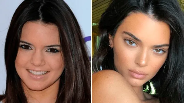 Kendall Jenner, antes y después