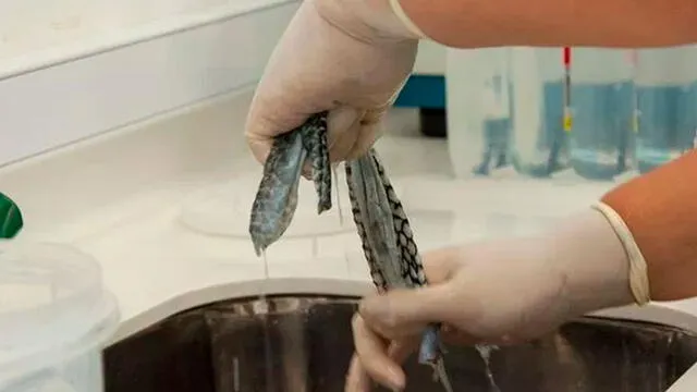 Mujer trans recibe implante vaginal hecho con piel de pescado [VIDEO]