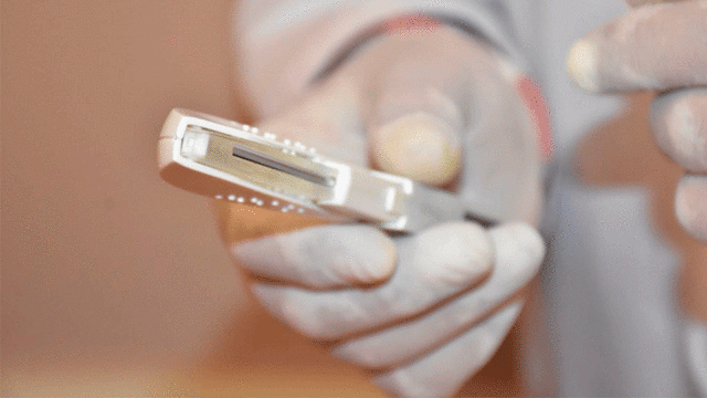 Los implantes subdérmicos tienen una duración de hasta 3 años. Foto: difusión