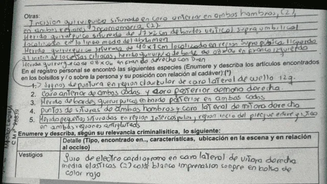  Detalles de la necropsia realizada a Muñequita Milly. Foto: La República 