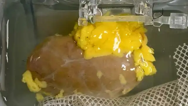  El riñón durante su preparación en el laboratorio. Foto: Nature Biomedical Engineering   