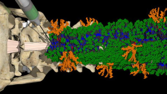 Nanofibras con dos señales de color naranja y verde reparan la médula espinal dañada. Foto: Mark Seniw