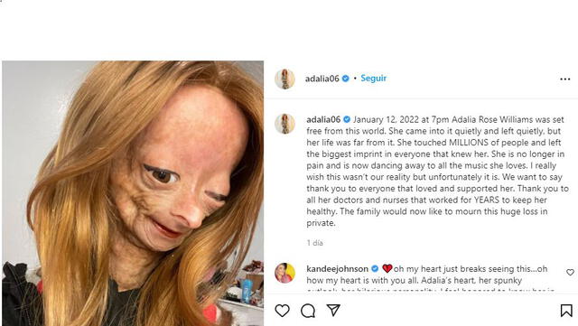 Comunicado del fallecimiento de Adalia Rose  Foto: Instagram