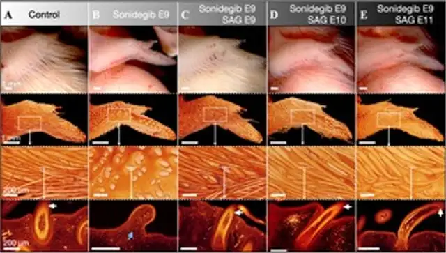 La manipulación de la cascada de señalización Sonic hedgehog (Shh) modificó el crecimiento del plumaje en etapas tempranas. Foto: PLOS Biology