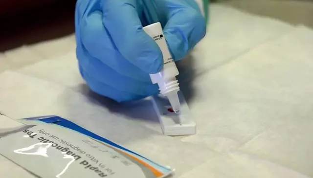 Los tests serológicos permiten detectar el coronavirus en diferentes fases de contagio. (Foto: El País)