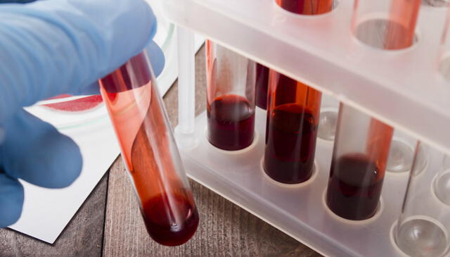 Identifican fuente de todas las células sanguíneas que podría revelar el origen del cáncer