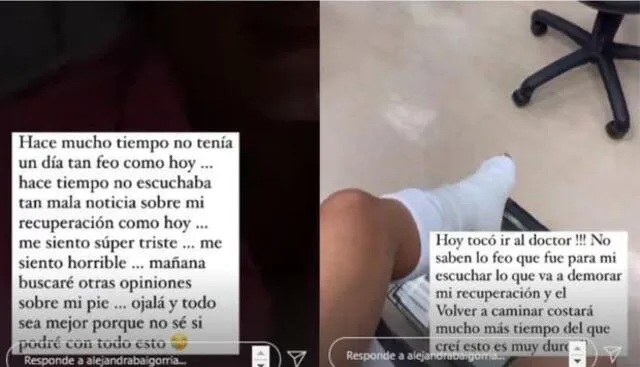 Alejandra Baigorria se muestra apenada en redes sociales por su lenta recuperación en su pie lesionado. Foto: Alejandra Baigorria/Instagram