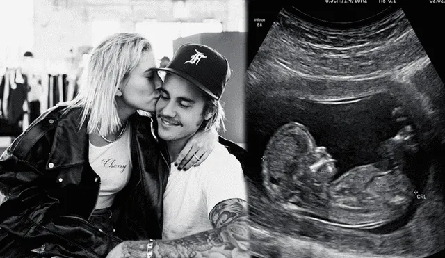 ¿Justin Bieber y Hailey Baldwin serán padres? Ecografía alborotó las redes
