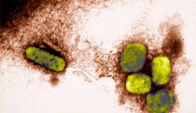 La variola mayor era la forma más común y severa de la viruela | Foto: CNN