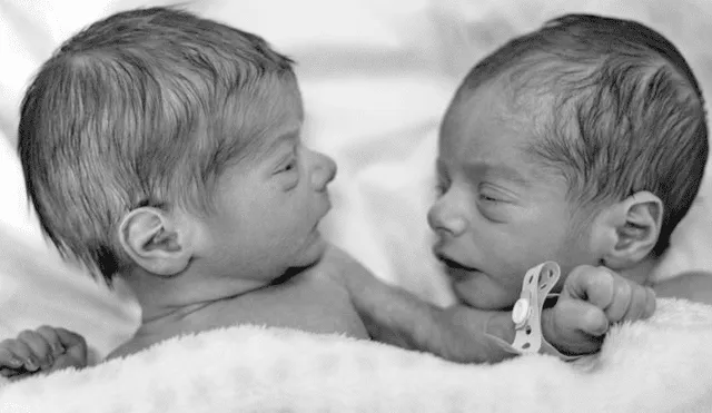 El insólito caso de las gemelas que nacieron en distintos años