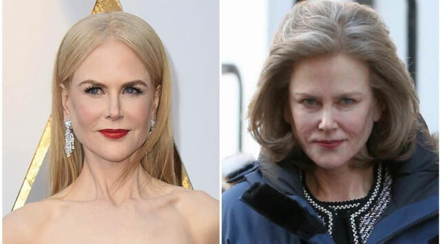 Nicole Kidman: conozca el radical cambio de rostro que luce la actriz