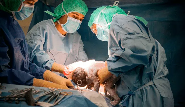 La madre llevó el ovillo de gasa en su organismo durante más de dos años, hasta que se lo descubrieron en 2011. Foto: El País