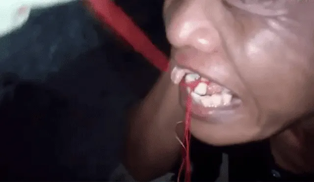 Facebook viral: joven pide a sus amigos que le extraigan el diente de insólita forma [VIDEO]