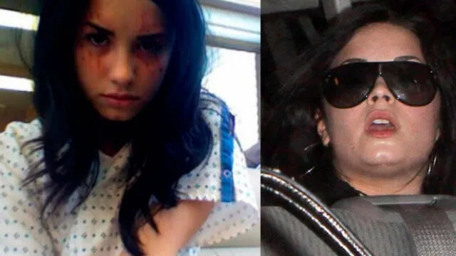Demi Lovato recae nuevamente en depresión por muerte de su perro [FOTOS]