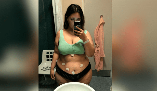 Facebook viral: chica pesó 120 kilos por abusar de comida chatarra, se sometió a cirugía y su aspecto enamoró [FOTOS] 
