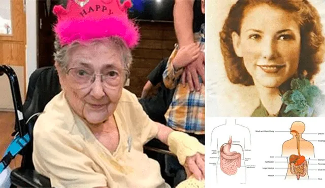 Mujer vivió hasta los 99 años con los órganos invertidos y nunca lo supo [FOTOS]