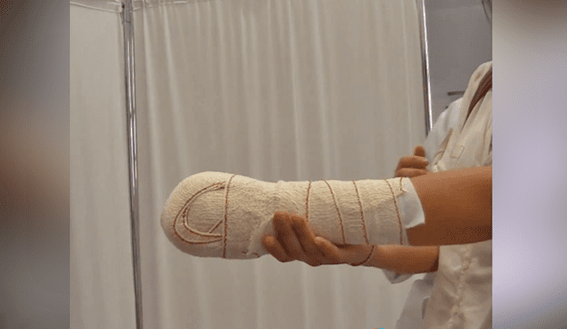 Mujer se amputa la mano con una sierra para cobrar casi 400.000 euros del seguro