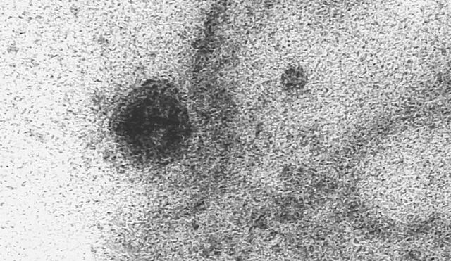 Imagen del coronavirus infectando una célula humana. Fuente: IOC / Fiocruz.