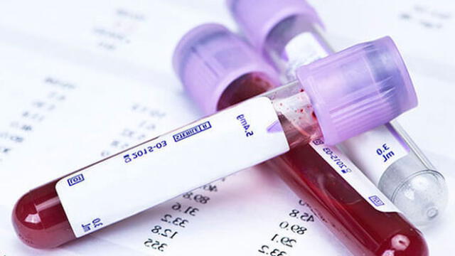 Siete tipos de cáncer podrán detectarse mediante nuevo análisis de sangre