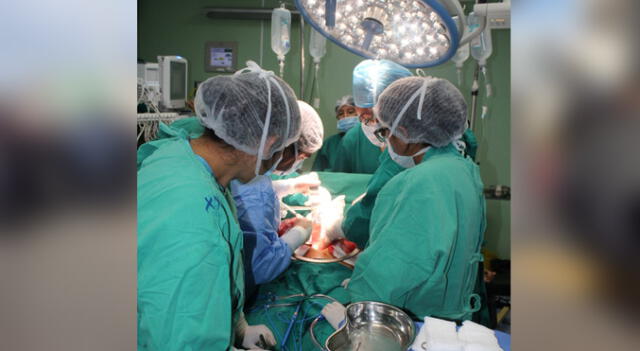 Cusco. Médicos especialistas operarán a pacientes con secuelas de quemaduras.