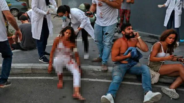 Personal médico del líbano asiste a los heridos por las explosiones. Foto: AFP.